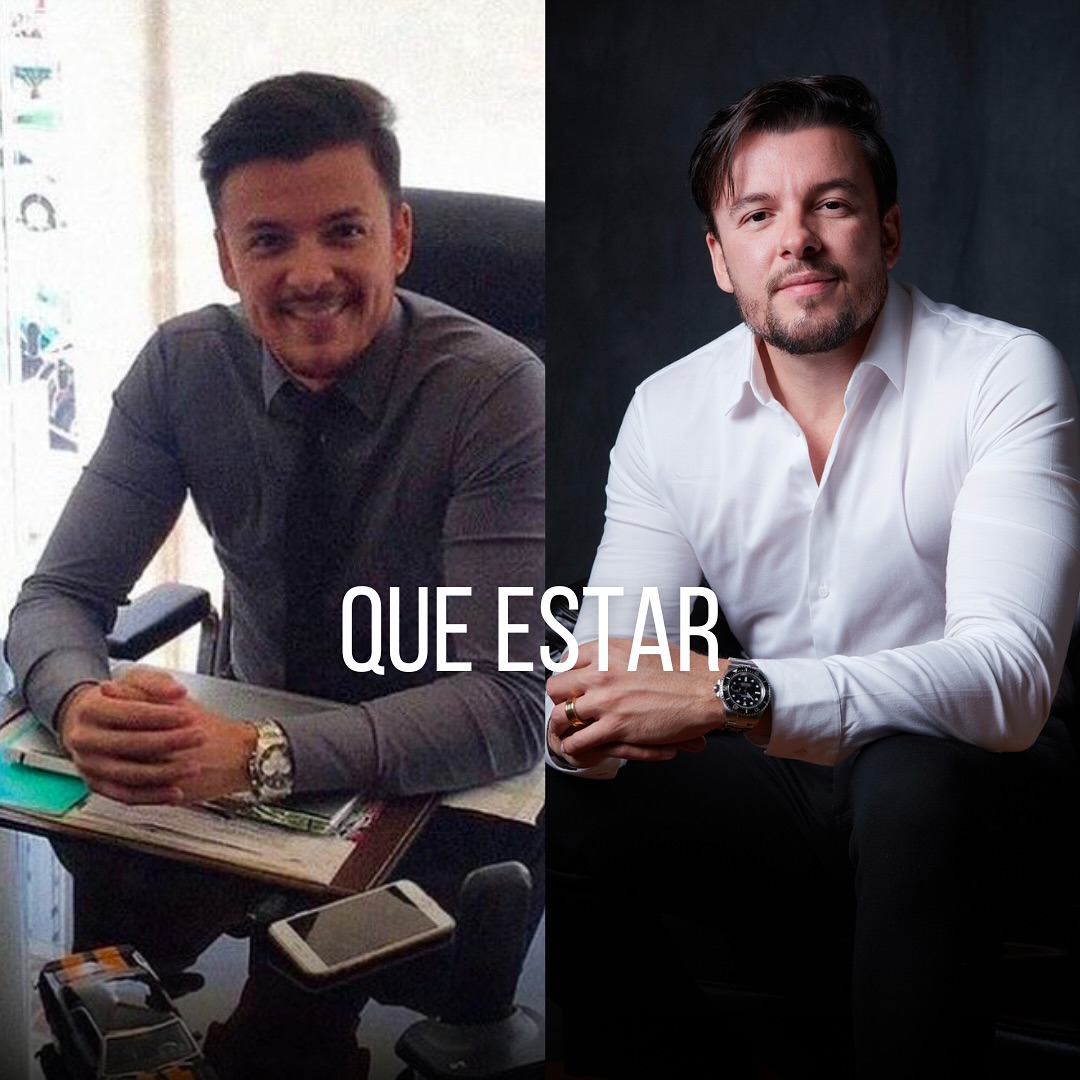 Antes e Depois Foto Essência